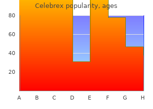 purchase celebrex 200 mg with amex